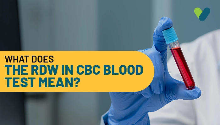 What Does MPV in CBC Test Mean?