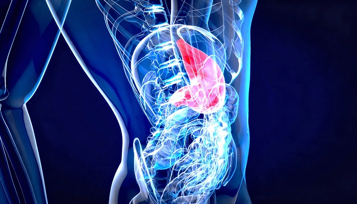 Causes of Gallstones
