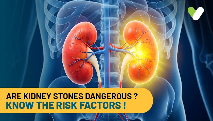 Are Kidney Stones Dangerous? Know The Risk Factors!