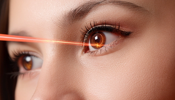 Recovery After LASIK Surgery