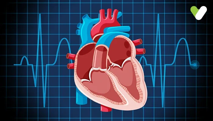 What is Eisenmenger Syndrome? Causes, Symptoms, Diagnosis, and Treatment Guide