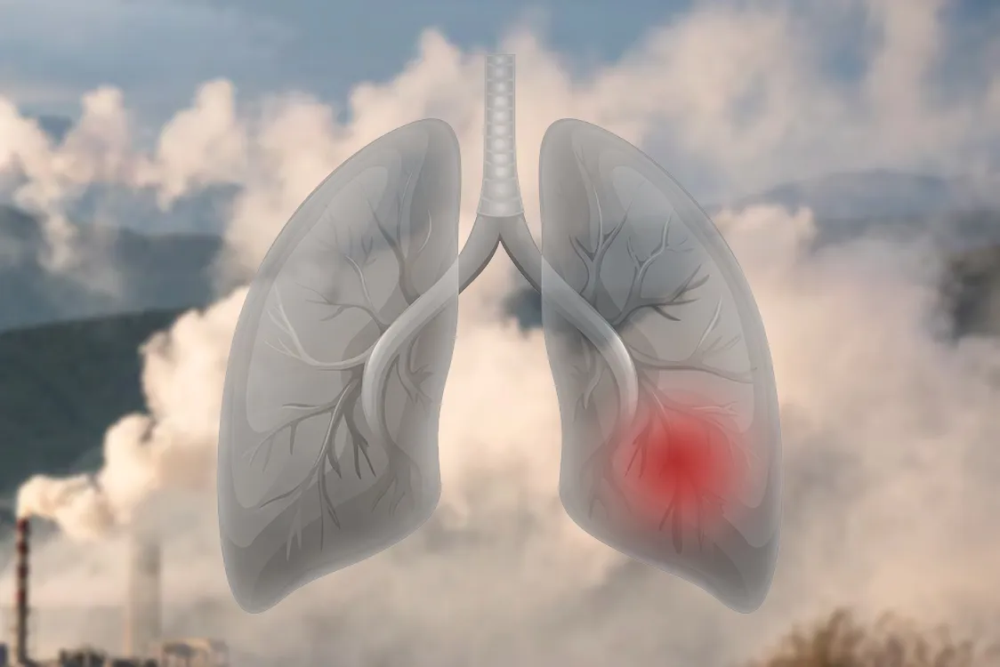 Air pollution can cause harm to the lungs that might be irreversible