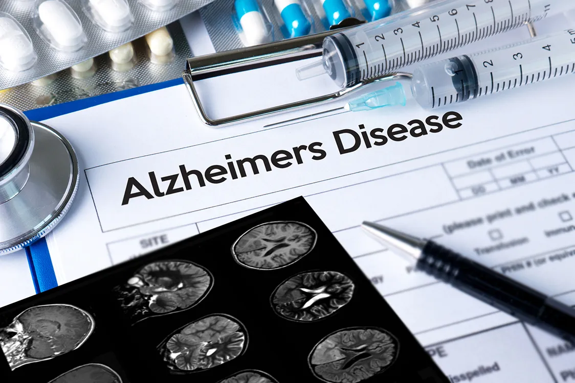 Red wine to reduce side effects of Alzheimer's disease