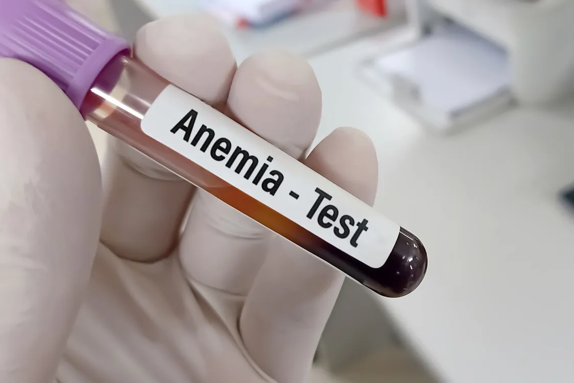 7.3 lakh women suffer from anaemia in Maharashtra: Survey