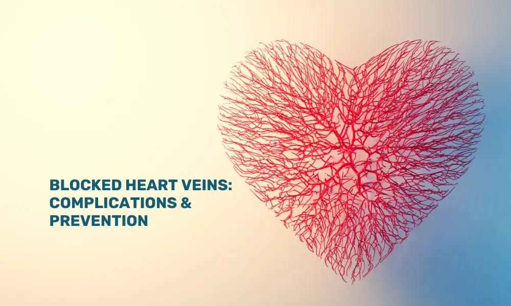 Prevention of Blocked heart veins