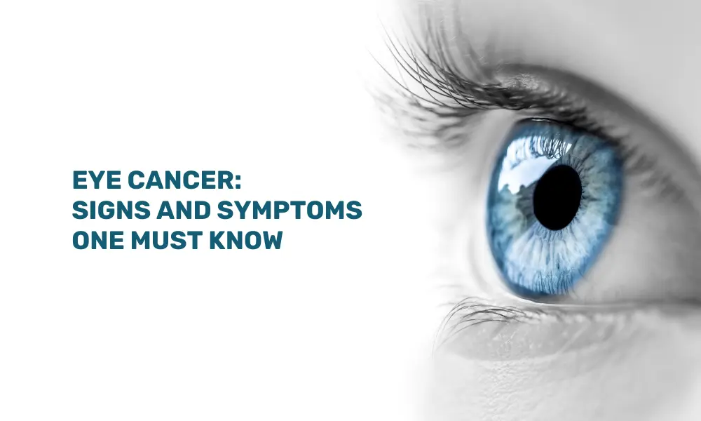 How to prevent eye cancer?