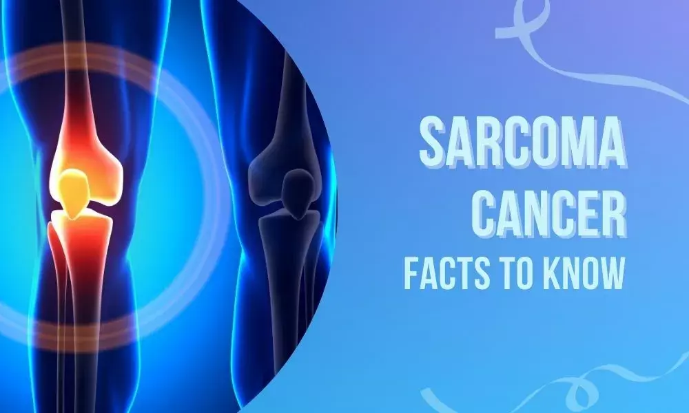 Sarcoma Cancer: Facts to Know!