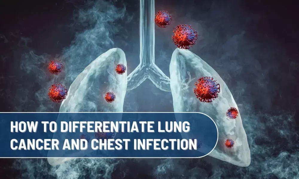 How to differentiate Lung Cancer and Chest Infection