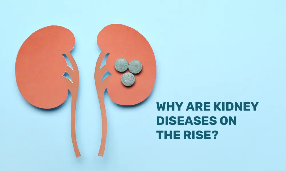 Ways To Manage Kidney Diseases