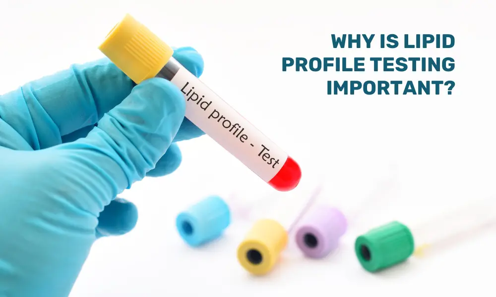 Importance of Lipid profile testing
