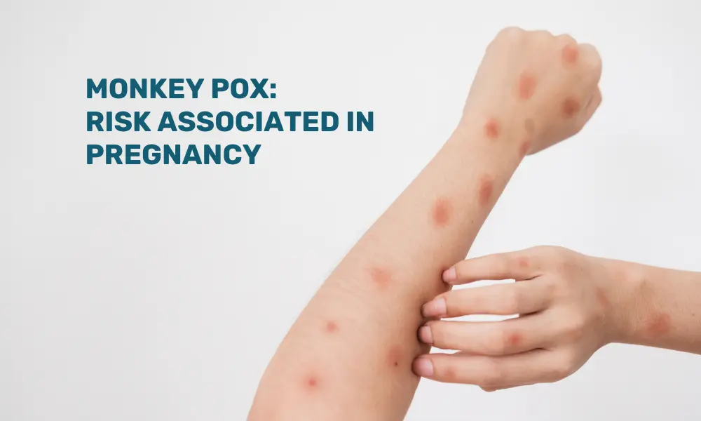 How to prevent Monkey pox?