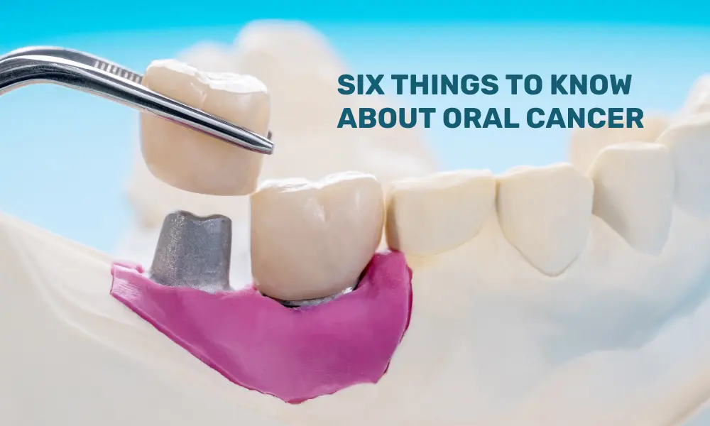 Things to Know about Oral Cancer