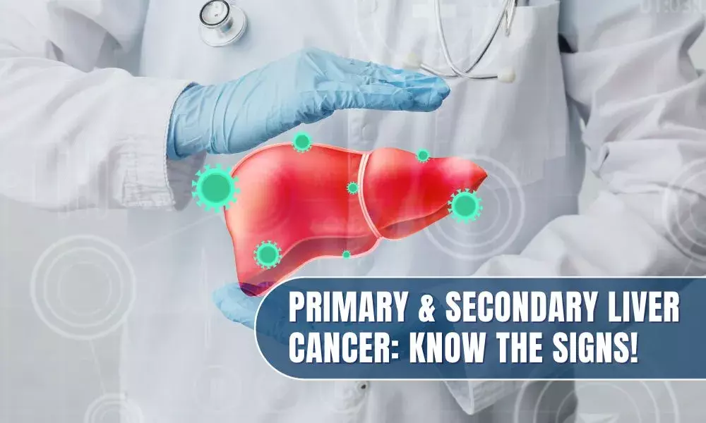 Primary & Secondary Liver Cancer: Know the signs!