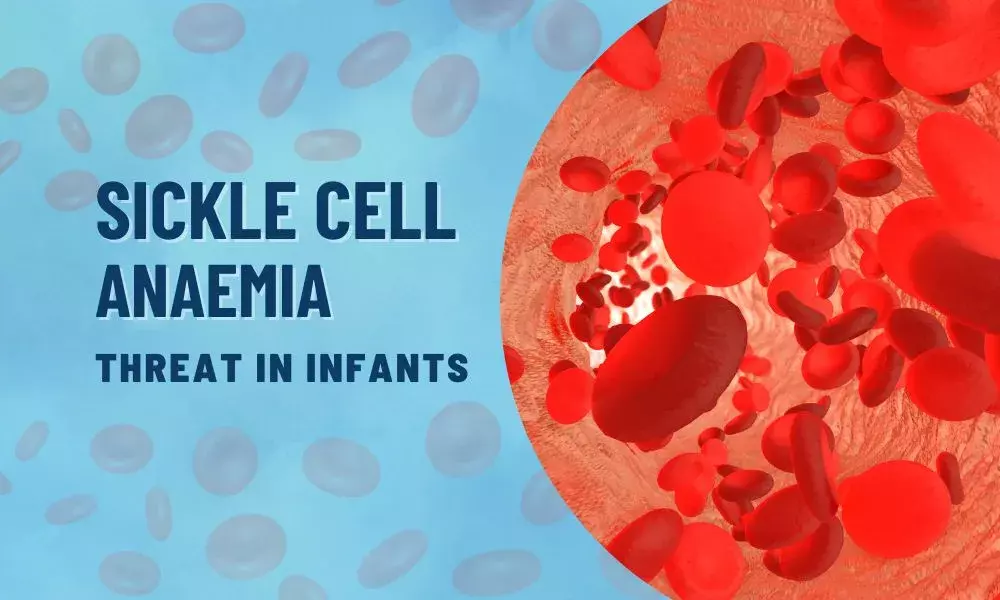 Sickle Cell Anaemia: Threat in Infants 