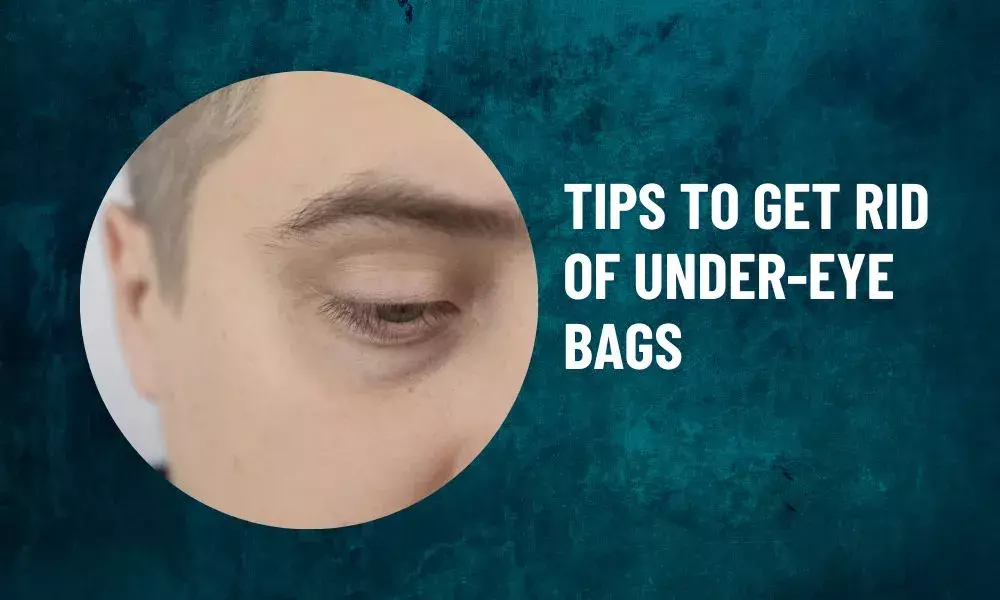 How to reduce puffy eyes?