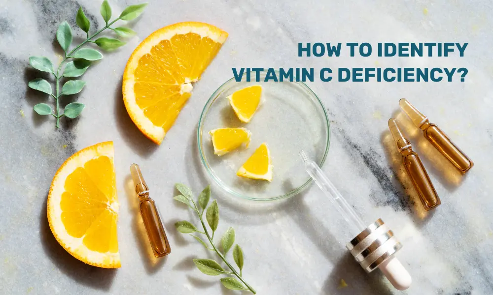 How to identify Vitamin C deficiency?