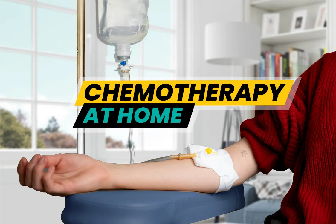 Mumbai: Doctors split over the idea of chemotherapy at home