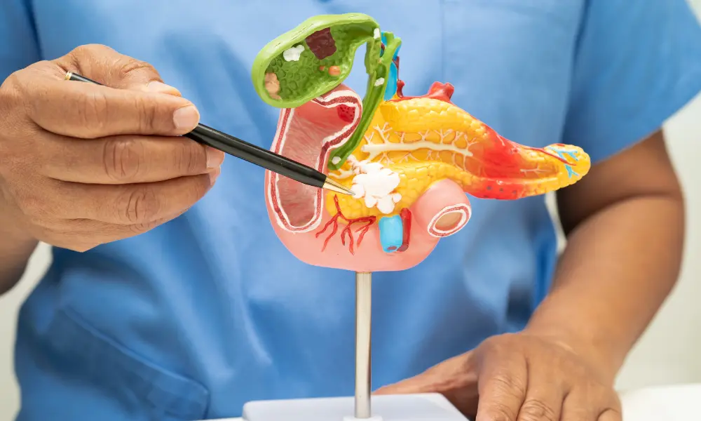 Risk Factors of Pancreatic Cancer