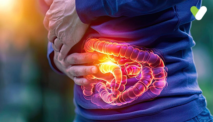 Know The Crohn's Disease Treatment And Its Impact
