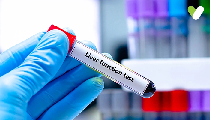 Liver Function Test – About, Normal Range, Preparation