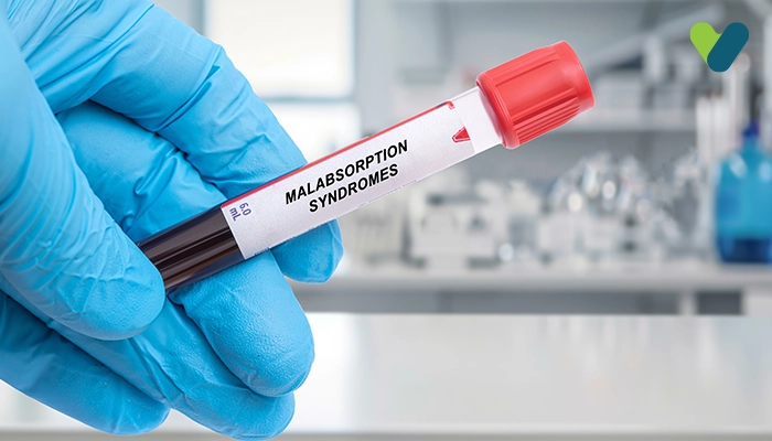 Causes & Different Types of Malabsorption Test