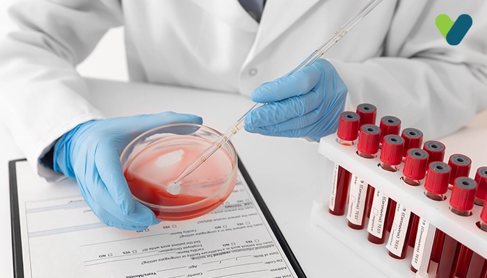 What is a Glycosylated Hemoglobin Test? Know everything