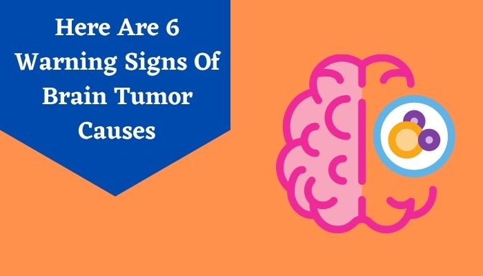 Here Are 6 Warning Signs Of Brain Tumor Causes