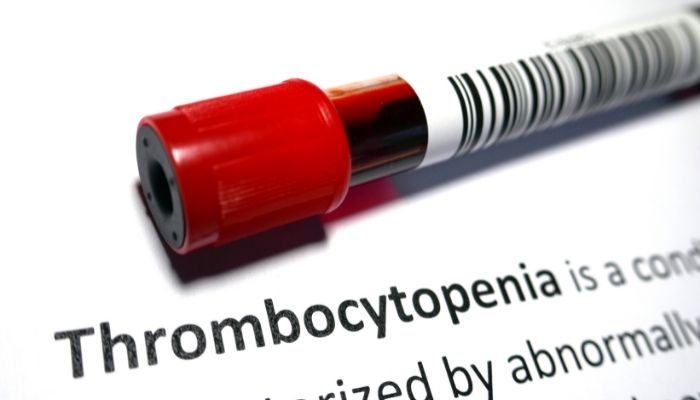 How is Thrombocytopenia Diagnosed