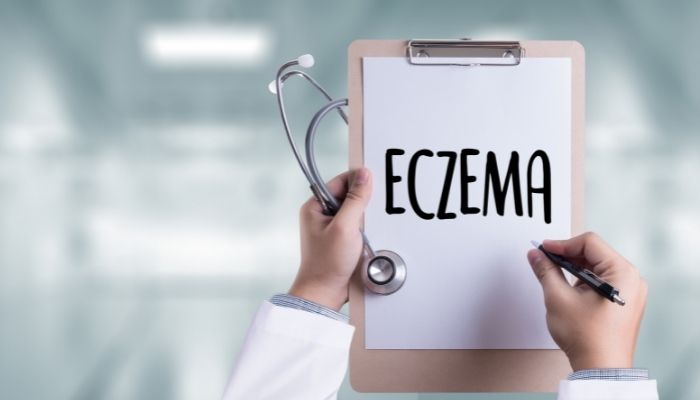 Treatment Options for Eczema