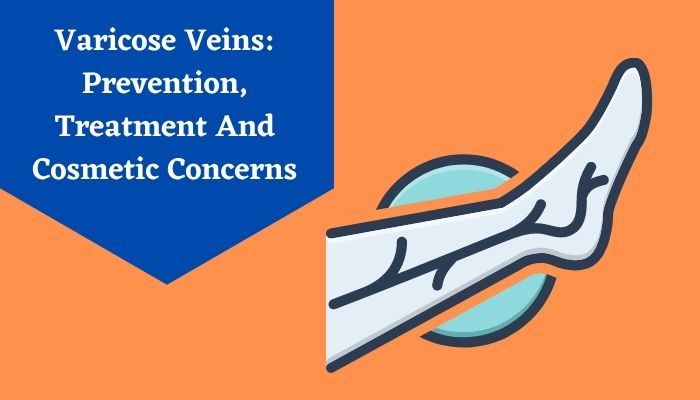 Varicose Veins Prevention, Treatment And Cosmetic Concerns
