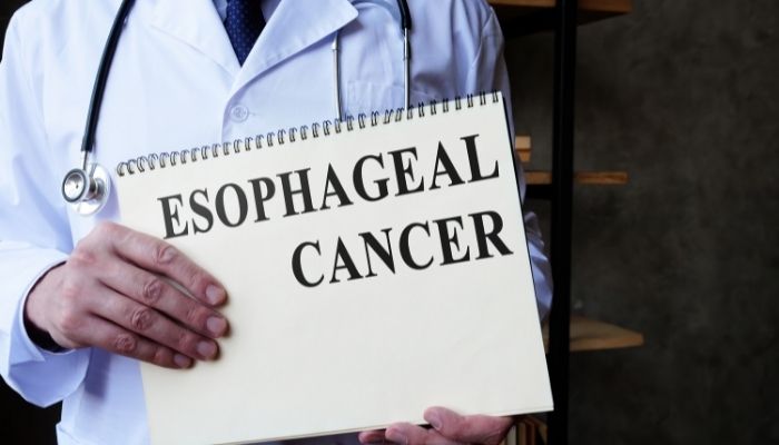 Greater Risk of Esophageal cancer