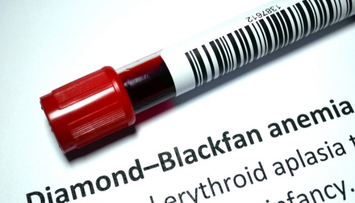 Diamond-Blackfan Anemia