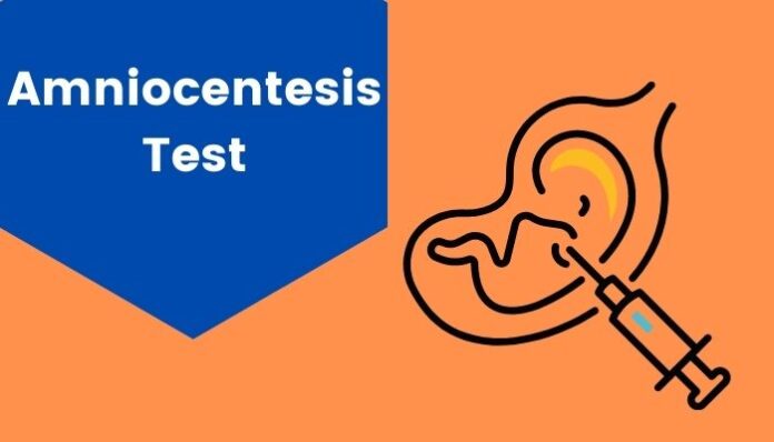 What Is An Amniocentesis Test