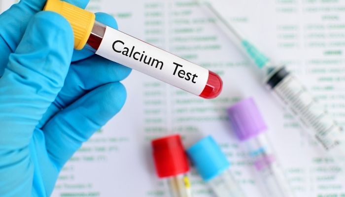 calcium blood test
