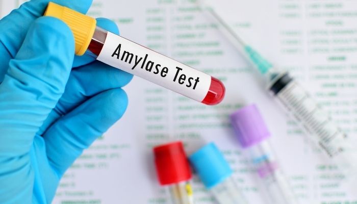 amylase test