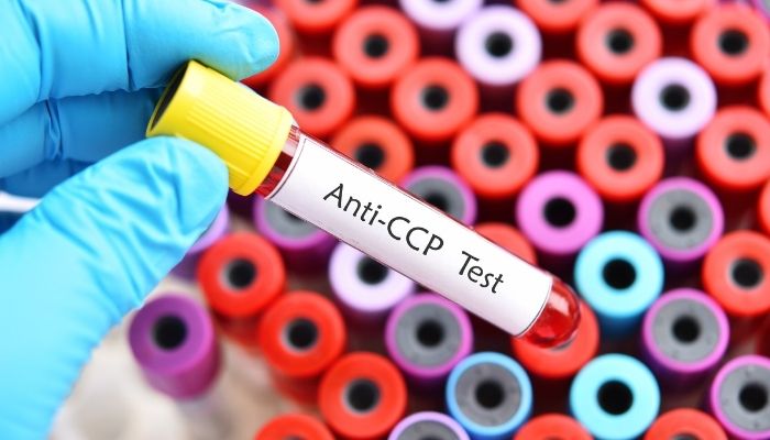 Anti- CCP Test