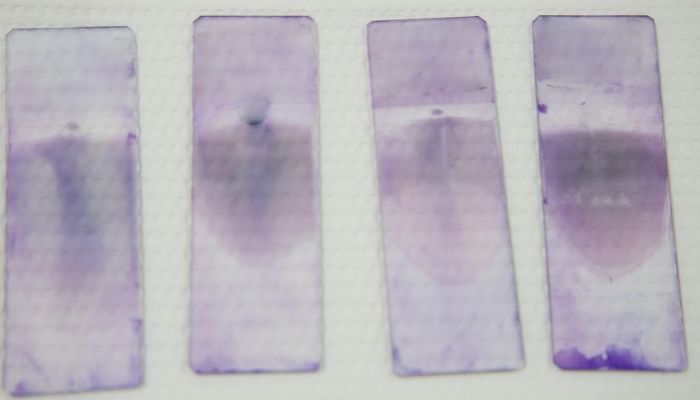 Blood Smear Test