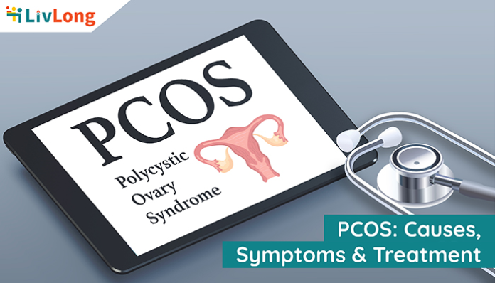 PCOS - Causes, Symptoms, and Treatment