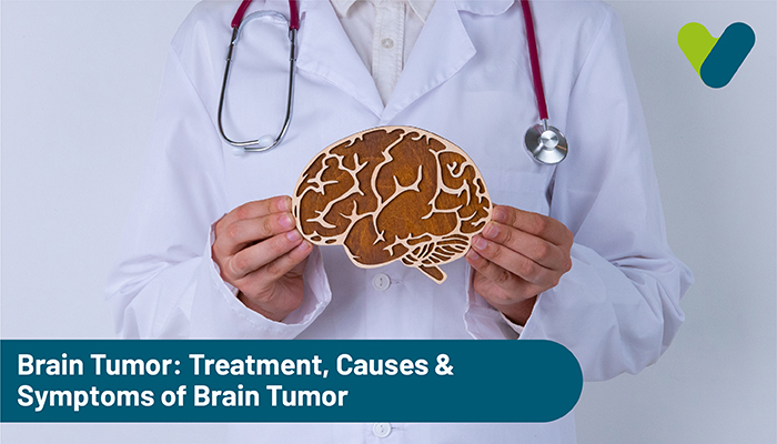 Brain Tumor: Treatment, Causes & Symptoms of Brain Tumor