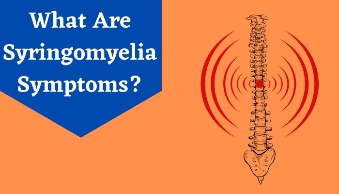What Are Syringomyelia Symptoms?