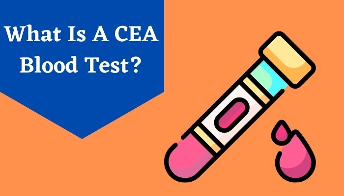 Complete Guide to CEA Blood Test
