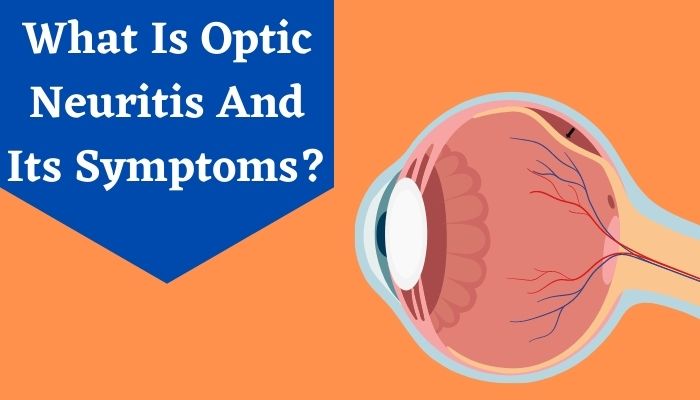 What Is Optic Neuritis And Its Symptoms?