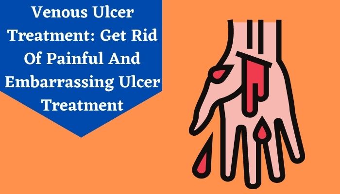 Venous Ulcer Treatment: Get Rid Of Painful And Embarrassing Ulcer Treatment