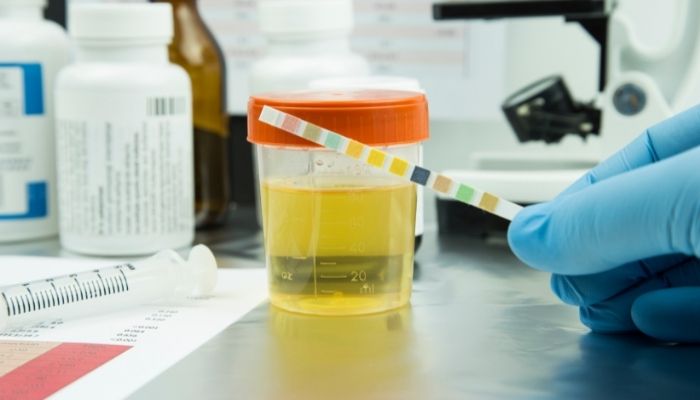 urine re test