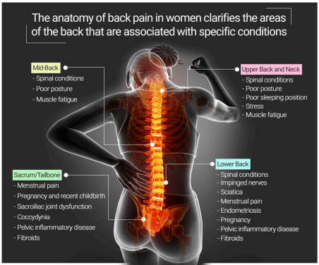 The anatomy of back pain women