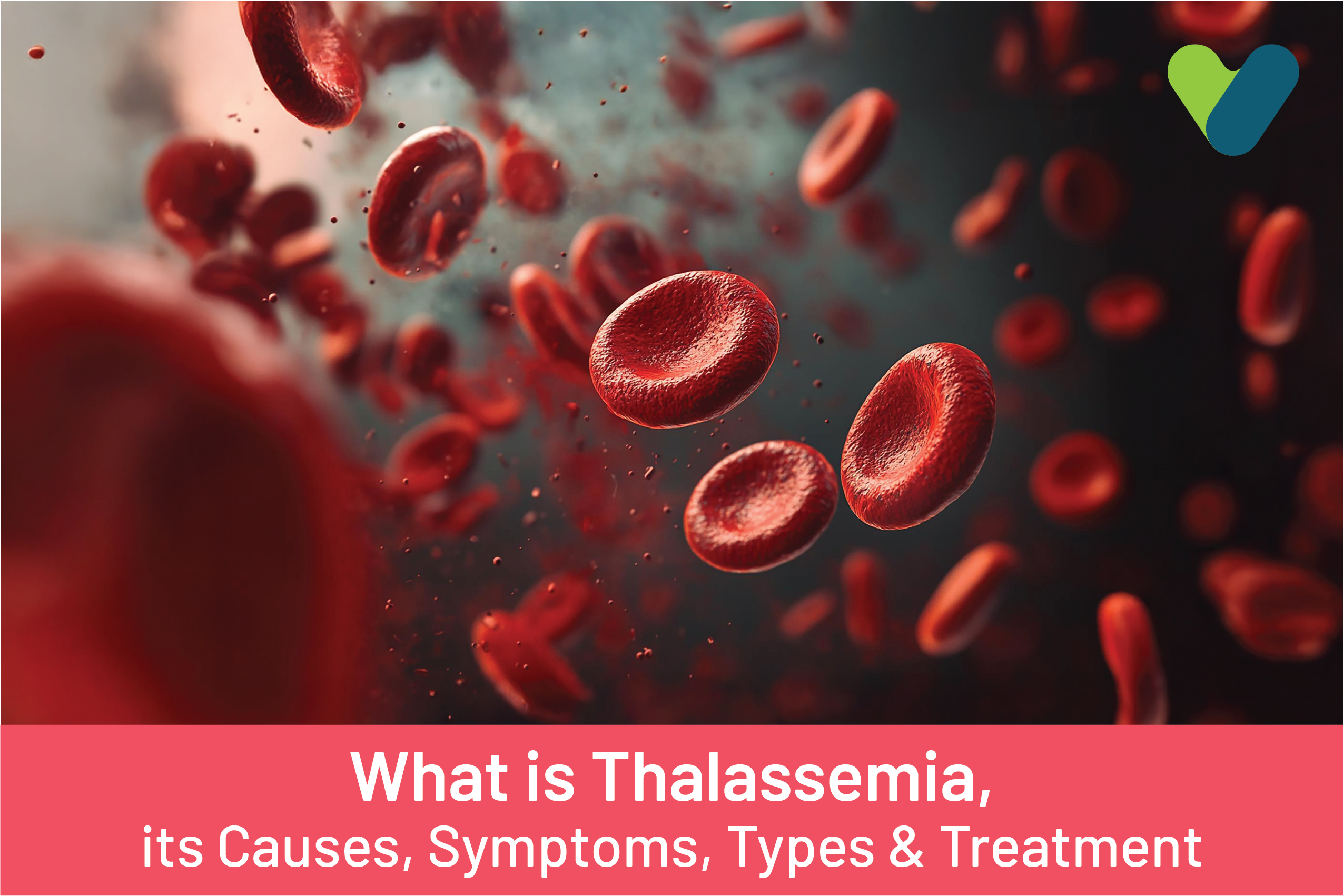 What is Thalassemia, its Causes, Symptoms, Types & Treatment