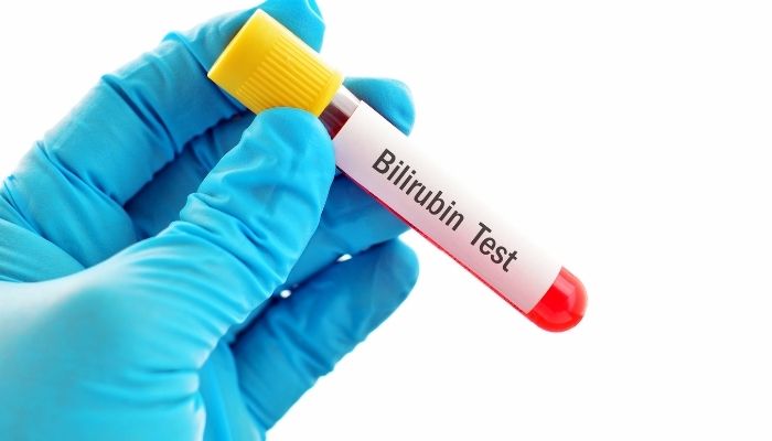 bilirubin test