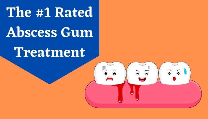 Abscess Gum Treatment