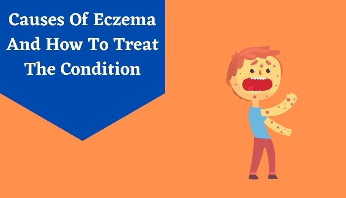 Causes Of Eczema And How To Treat The Condition
