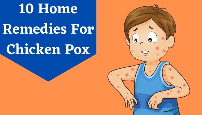 10 Home Remedies For Chicken Pox